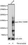 Western blot - Phospho-JAK2-Y1008 Rabbit pAb (AP0772)