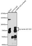 Western blot - Phospho-Lamin A/C-S22 Rabbit pAb (AP0777)