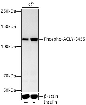 Phospho-ACLY-S455 Rabbit pAb