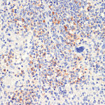 Western blot - Phospho-PLC gamma 2 (PLCG2)-Y1217 Rabbit pAb (AP0805)