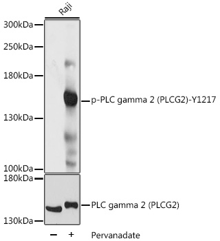 Phospho-PLC gamma 2 (PLCG2)-Y1217 Rabbit pAb