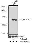 Western blot - Phospho-Vimentin-S39 Rabbit pAb (AP0806)