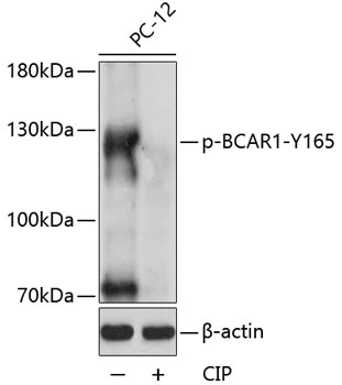 Phospho-BCAR1-Y165 Rabbit pAb