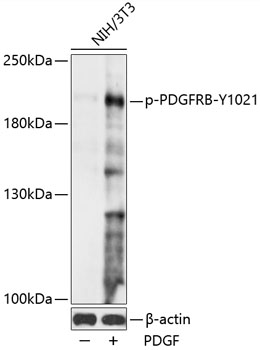 Phospho-PDGFRB-Y1021 Rabbit pAb