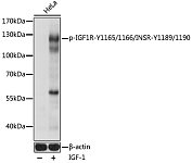 Western blot - Phospho-IGF1R-Y1165/1166/INSR-Y1189/1190 Rabbit pAb (AP0902)