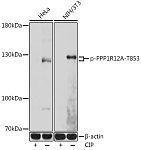 Western blot - Phospho-PPP1R12A-T853 Rabbit pAb (AP0916)