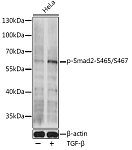 Western blot - Phospho-Smad2-S465/S467 Rabbit pAb (AP0925)