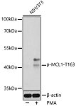 Western blot - Phospho-MCL1-T163 Rabbit pAb (AP0943)