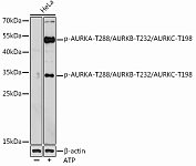 Western blot - Phospho-AURKA-T288/AURKB-T232/AURKC-T198 Rabbit pAb (AP0948)