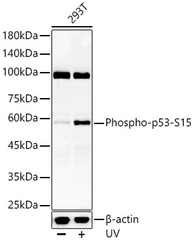 Phospho-p53-S15 Rabbit pAb