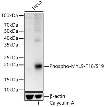 Phospho-MYL9-T18/S19 Rabbit pAb