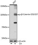 Western blot - Phospho-β-Catenin-S33/S37 Rabbit mAb (AP0979)