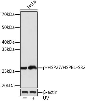 Phospho-HSP27/HSPB1-S82 Rabbit mAb