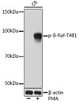 Western blot - Phospho-B-Raf-T401 Rabbit mAb (AP1041)