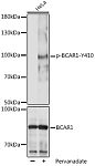 Western blot - Phospho-BCAR1-Y410 Rabbit pAb (AP1058)