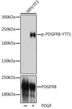 Phospho-PDGFRB-Y771 Rabbit pAb