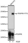 Western blot - Phospho-PDGFRB-Y771 Rabbit pAb (AP1062)