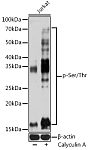 Western blot - pan Phospho-Serine/Threonine Mouse mAb (AP1067)