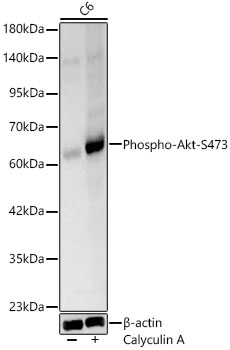 Phospho-Akt-S473 Rabbit pAb