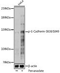 Western blot - Phospho-E-Cadherin-S838/S840 Rabbit pAb (AP1074)
