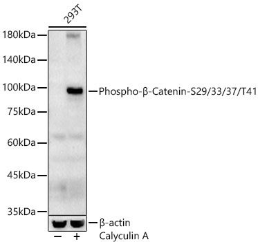 Phospho-β-Catenin-S29/33/37/T41 Rabbit pAb