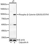 Western blot - Phospho-β-Catenin-S29/33/37/T41 Rabbit pAb (AP1076)