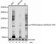 Western blot - Phospho-PSD93/chapsyn-110/DLG2-Y340 Rabbit pAb (AP1080)