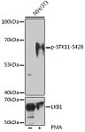Western blot - Phospho-STK11-S428 Rabbit pAb (AP1108)