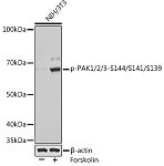 Western blot - Phospho-PAK1/2/3-S144/S141/S139 Rabbit mAb (AP1158)