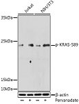 Western blot - Phospho-KRAS-S89 Rabbit pAb (AP1168)