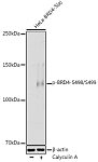 Western blot - Phospho-BRD4-S498/S499 Rabbit pAb (AP1179)