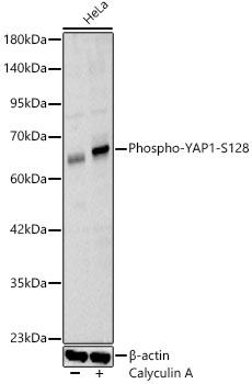 Phospho-YAP1-S128 Rabbit pAb