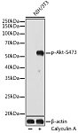 Western blot - Phospho-Akt-S473 Rabbit mAb (AP1208)