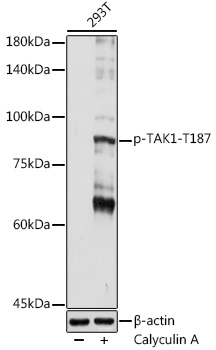 Phospho-TAK1-T187 Rabbit pAb