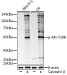 Western blot - Phospho-Akt-T308 Rabbit mAb (AP1259)