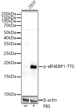 Phospho-eIF4EBP1-T70 Rabbit mAb