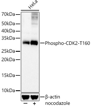 Phospho-CDK2-T160 Rabbit mAb