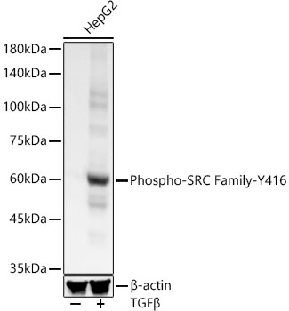 Phospho-SRC Family-Y416 Rabbit mAb