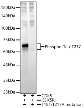 Phospho-Tau-T217 Rabbit mAb