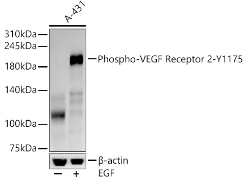 Phospho-VEGF Receptor 2-Y1175 Rabbit mAb