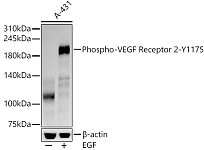 Western blot - Phospho-VEGF Receptor 2-Y1175 Rabbit mAb (AP1385)