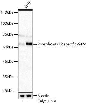 Phospho-AKT2 specific-S474 Rabbit pAb