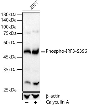 Phospho-IRF3-S396 Rabbit mAb
