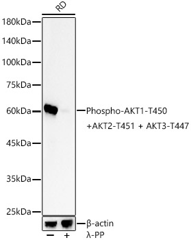 Phospho-AKT1-T450 + AKT2-T451 + AKT3-T447 Rabbit mAb
