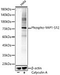 Western blot - Phospho-YAP1-S127 Rabbit mAb (AP1436)