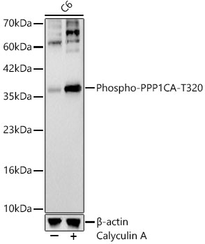Phospho-PPP1CA-T320 Rabbit mAb