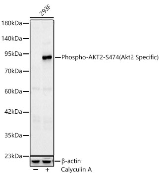 Phospho-AKT2-S474(Akt2 Specific) Rabbit mAb