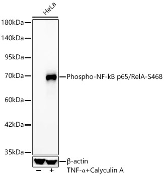 Phospho-NF-kB p65/RelA-S468 Rabbit mAb