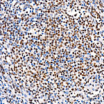 Western blot - Phospho-ACLY-S455 Rabbit mAb (AP1474)