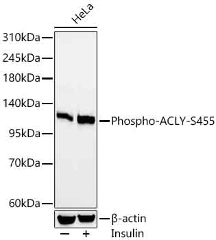 Phospho-ACLY-S455 Rabbit mAb